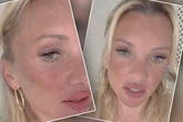 Evelyn Burdecki erlebt teuren Beauty-Fail: "Könnt Ihr das sehen?"