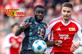 Krasse Ansage: Bayerns Siegesserie reißt "bei Union"