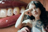 Zahnschmuck feiert sein Comeback: Leipzigerin bringt Glitzer ins Lächeln