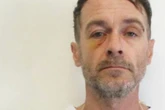 Straftäter aus Psychiatrie geflohen: Polizei warnt vor diesem Mann