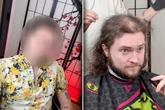 Mann will wegen Haarausfall Glatze haben: Was Frisur stattdessen macht, haut ihn um