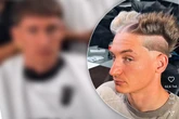 YouTuber schockt mit "Firestarter"-Frise: So sah er vorher aus