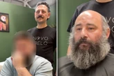 Mann erhält Toupet: Was er danach gesteht, kommt völlig unerwartet