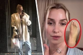 Lena Gercke nach Unfall total frustriert: "Ding der Unmöglichkeit"
