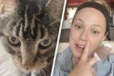 Frau wird von eigener Katze verletzt - danach folgen Wochen voller Arztbesuche