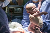 Frau mit gespendeter Gebärmutter bringt Baby zur Welt