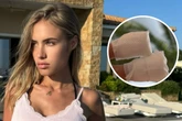 Alena Gerber erlebt absoluten Albtraum nach Knochenbruch