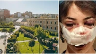 Ragazza aggredita brutalmente in un parco a Bari, il sindaco: “Episodio indegno”