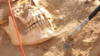 The real killer of Napoleon’s army revealed by DNA testing