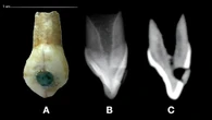 Jade gems decorated these Mayan kids’ teeth
