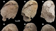 Ancient cone-shaped skull shows signs of fatal trauma