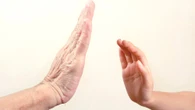 Skin wrinkles because it stretches like Silly Putty