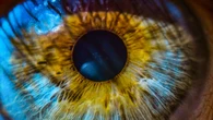 LASIK without the laser? Rabbit eyeballs hint at a new option