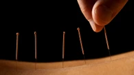 Oldest known steel acupuncture needles discovered in disgraced emperor’s tomb