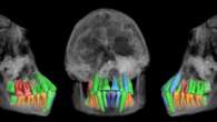 These 1.77-million-year-old teeth could help demystify human childhoods