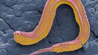 Why we die: Lessons on genes from a lowly worm