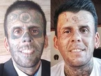 Man with tattoos on 95% of his body documents painstaking removal process
