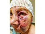 Ontario dog attack victim told herself 'I think you're dead'