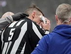 Referee forced out of Game 7 in Toronto after taking stick to face