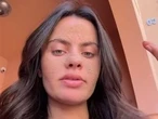 Canadian influencer defends controversial ‘caveman skincare routine’