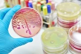 AI helps Ont. researcher discover breakthrough antibiotic treatment for bowel disease