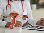 Training for docs coming as women wait years in pain for endometriosis diagnoses