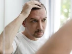 What you’re drinking may be causing hair loss: Study