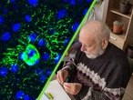 El alzhéimer empieza antes de los síntomas que conocemos y una proteína puede cambiar todo 