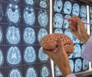 Científicos descubren que el tálamo cerebral no solo filtra, también hace posible la percepción consciente y la regula  