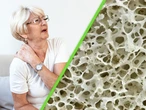 Científicos descubren cómo estimular un receptor para reconstruir huesos y, por fin, combatir la osteoporosis 