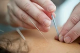 A Béziers, le projet controversé du premier campus de "médecine chinoise" en Europe