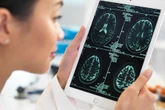 Maladie d’Alzheimer : "La générosité du public est essentielle pour soutenir la recherche"