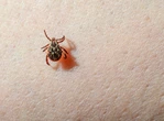 What to know about alpha-gal syndrome, the life-threatening meat allergy caused by tick bites
