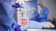 People who donate kidneys to strangers would get $50K tax credit if this law passes
