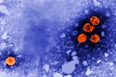 2 scientists charged with bringing deactivated mpox virus into U.S. and lying to authorities