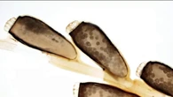 Body lice were found at the University of Maryland. What to know about the pests