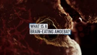 Texas woman dies from brain-eating amoeba after cleaning sinuses with tap water