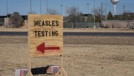 U.S. measles cases soar to 35-year high in 2026, already surpassing all of 2025
