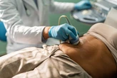 Most U.S. doctors are quietly using this AI tool. Few patients know about it