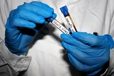 Canadian MV Hondius cruise passenger tests positive for hantavirus