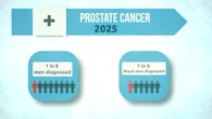 Prostate cancer survivor was told he was too young to get screened. Here's his advice