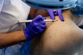 How a dermatologist monitors herself for skin cancer and the ‘big sign' a mole may be melanoma