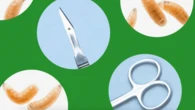 Got maggots? These doctors are bringing the bugs into their practice on purpose