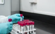 Could Lessons from the Covid-19 Response Boost HIV Research?