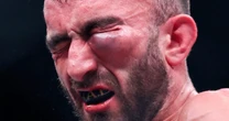 Peleador de UFC pierde tras hinchazón del tamaño de una ‘pelota de golf’ en el ojo: Así fue su lesión