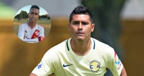 ¿Qué es la esclerodermia, enfermedad que tiene Osvaldo Martínez, exjugador del América?