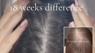 I fixed my thinning hair thanks to a 20p a go buy that uses thyme