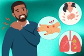 From killer cancer to 999 emergency - when shoulder pain could be more serious