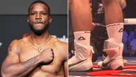 Fighter at Conor McGregor's bareknuckle event wears ankle tag during bout