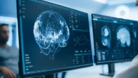 Remembering key word could help prevent third of Alzheimer’s cases, says expert